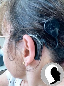 CI Kopf 2022 weiblich